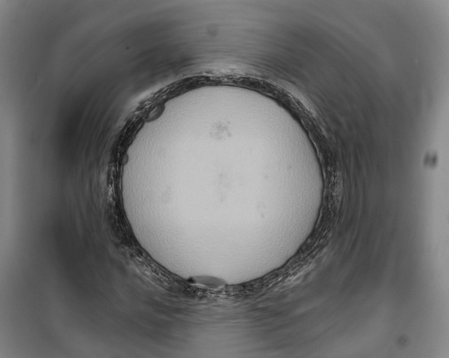 X0000099381016200806051116