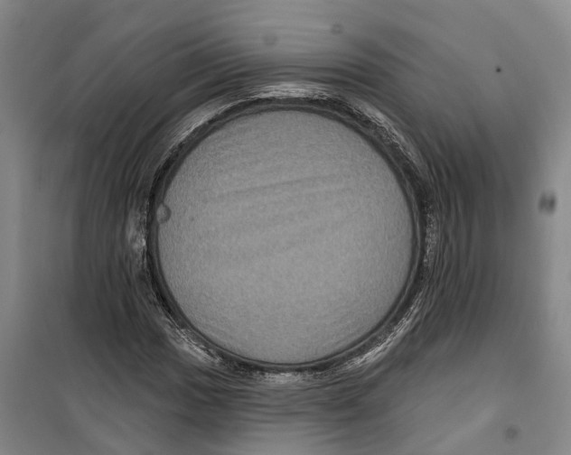 X0000099381017200806051116