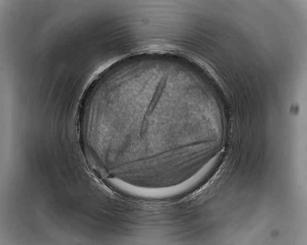 X0000099381018200806051116