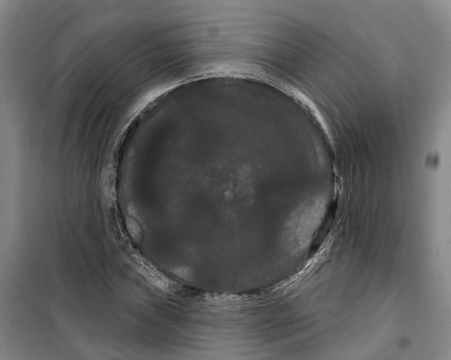 X0000099381019200806051116