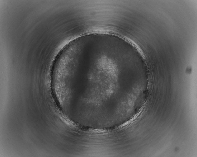 X0000099381027200806051116