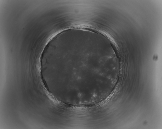 X0000099381031200806051116