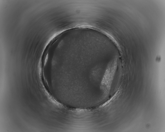 X0000099381032200806051116