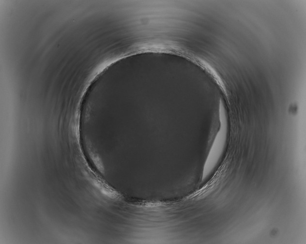 X0000099381035200806051116