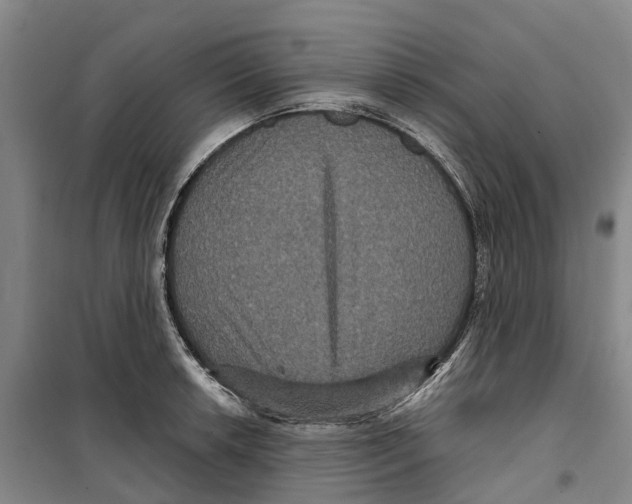 X0000099381042200806051116