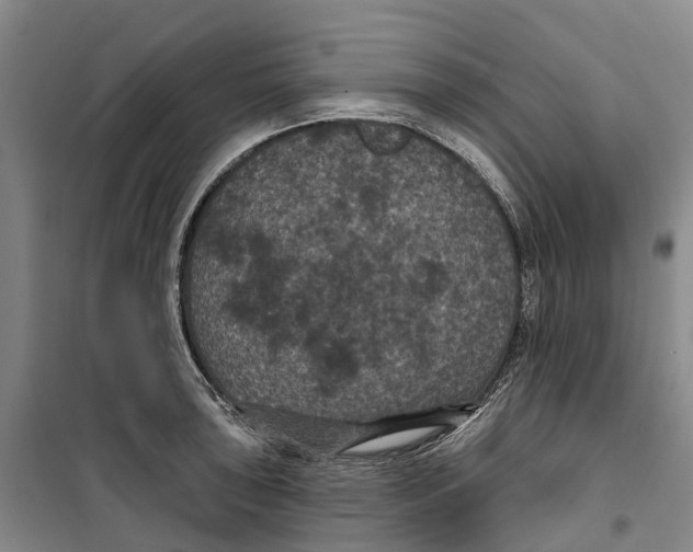 X0000099381043200806051116
