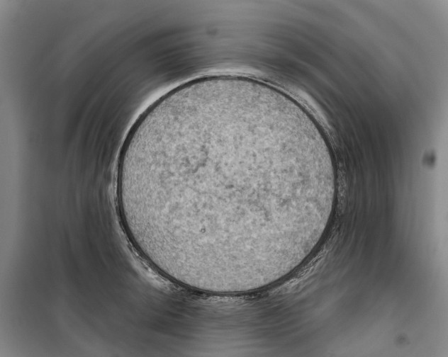 X0000099381044200806051116