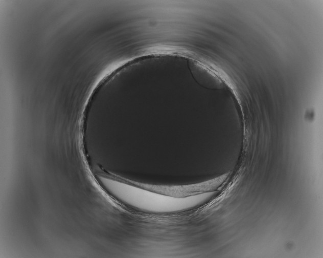 X0000099381045200806051116