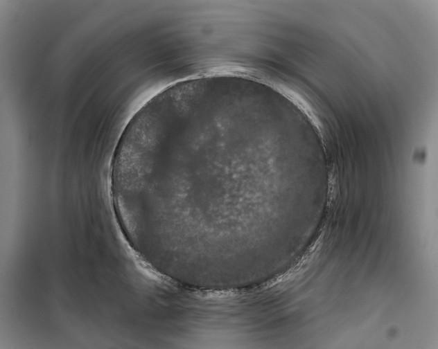 X0000099381047200806051116