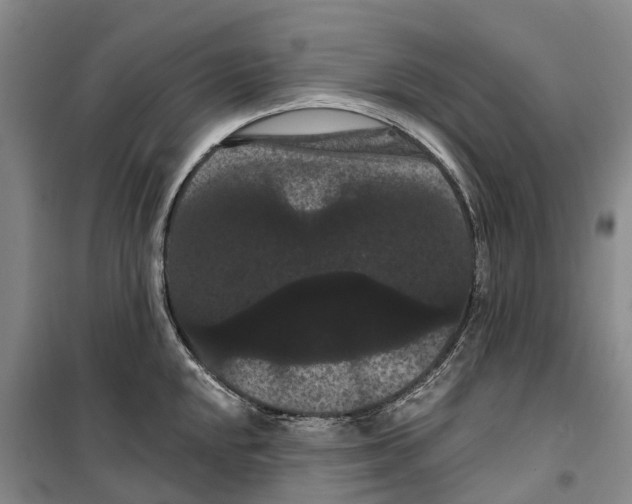 X0000099381048200806051116