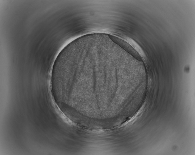 X0000099381052200806051116