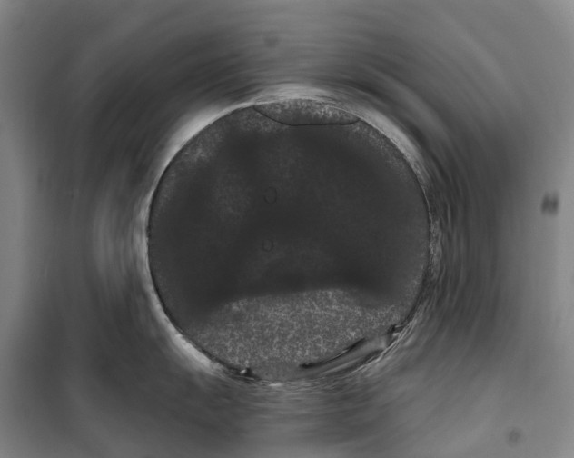 X0000099381055200806051116