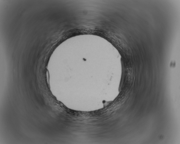 X0000099381057200806051115
