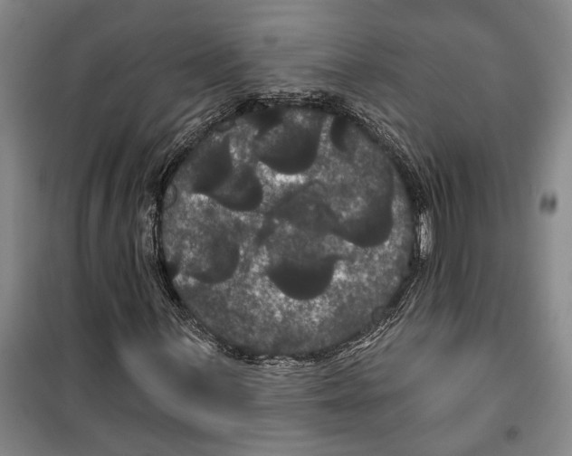 X0000099381059200806051115