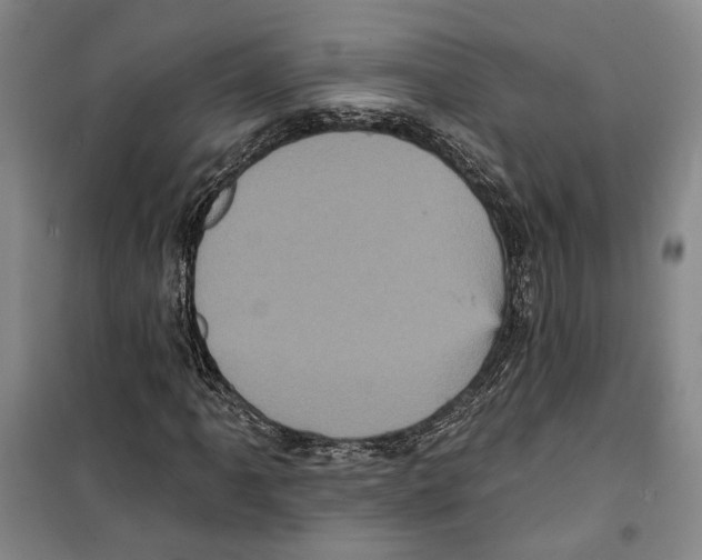 X0000099381061200806051115