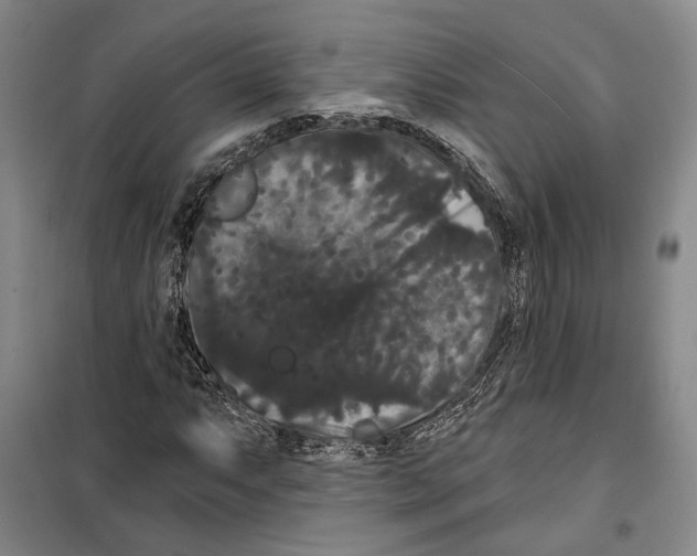 X0000099381063200806051115
