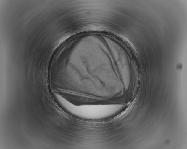 X0000099381065200806051115