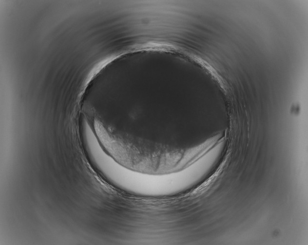 X0000099381066200806051115