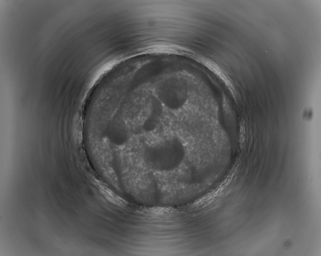 X0000099381067200806051115