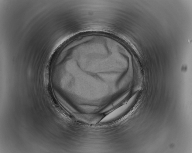 X0000099381069200806051115