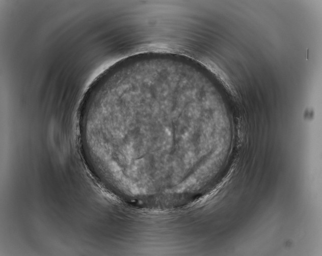 X0000099381070200806051115