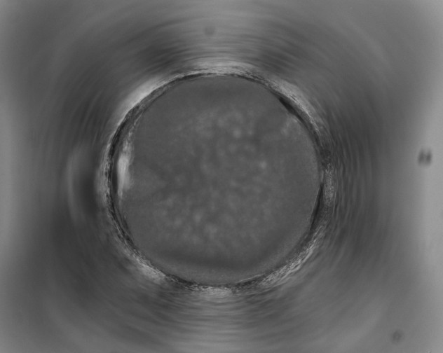 X0000099381071200806051115