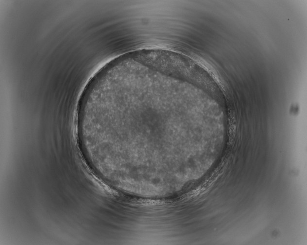 X0000099381076200806051115