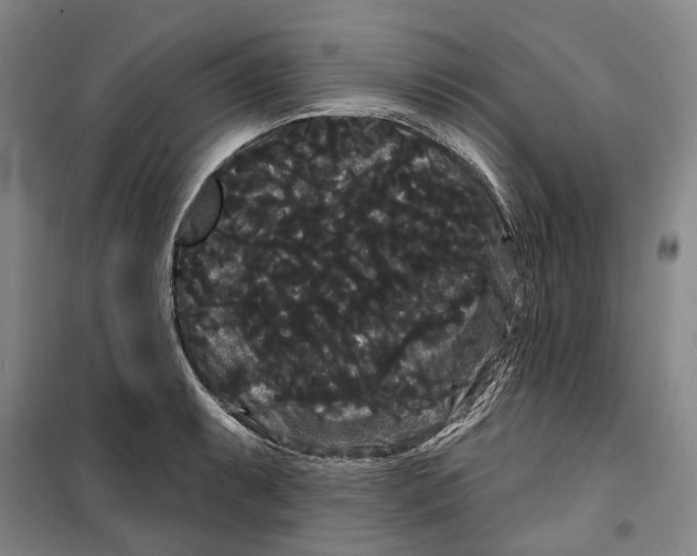 X0000099381087200806051115