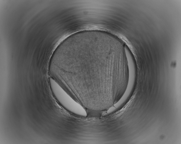 X0000099381089200806051115