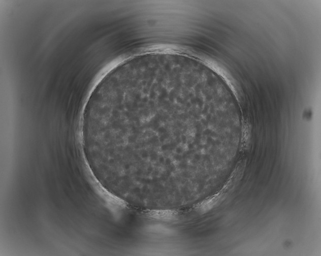 X0000099381090200806051115