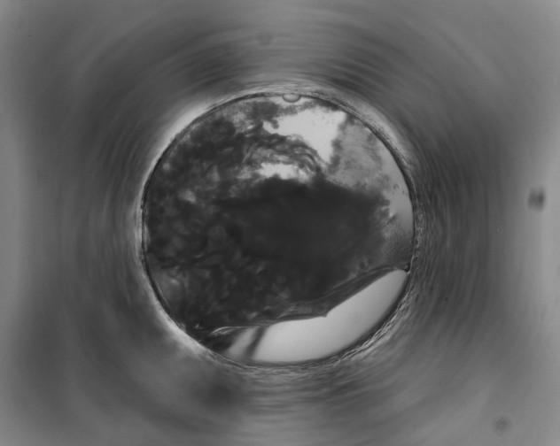 X0000099381095200806051115