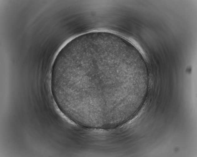 X0000099381100200806051115