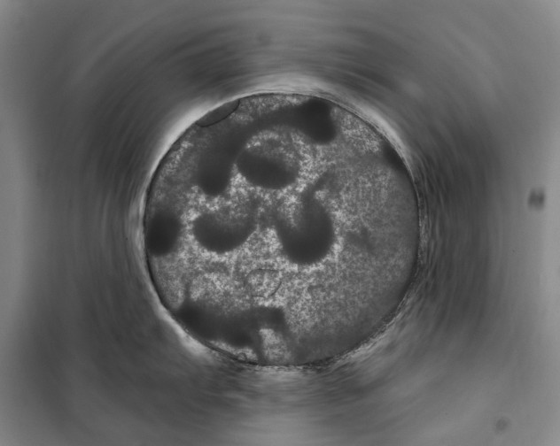 X0000099381103200806051115