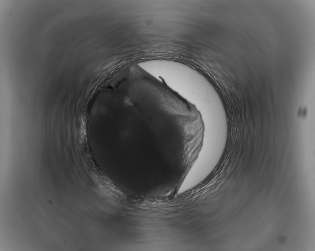 X0000099381106200806051114