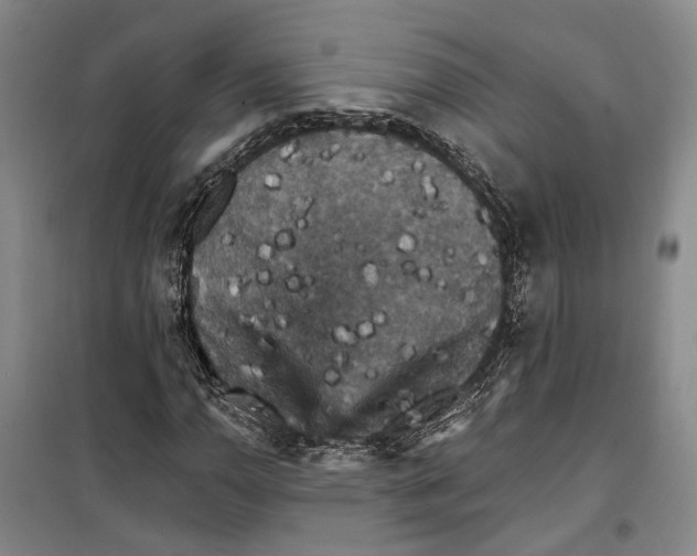 X0000099381110200806051114