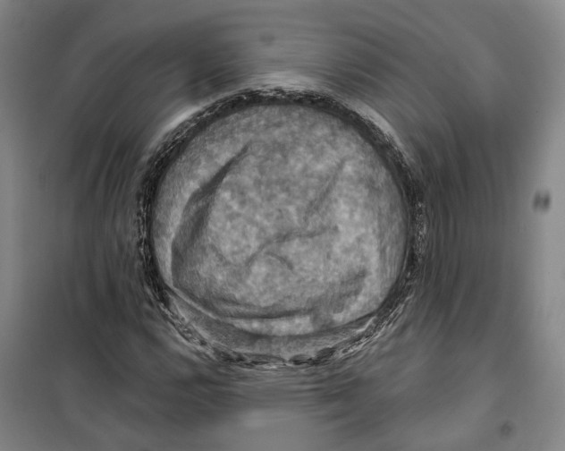 X0000099381112200806051114