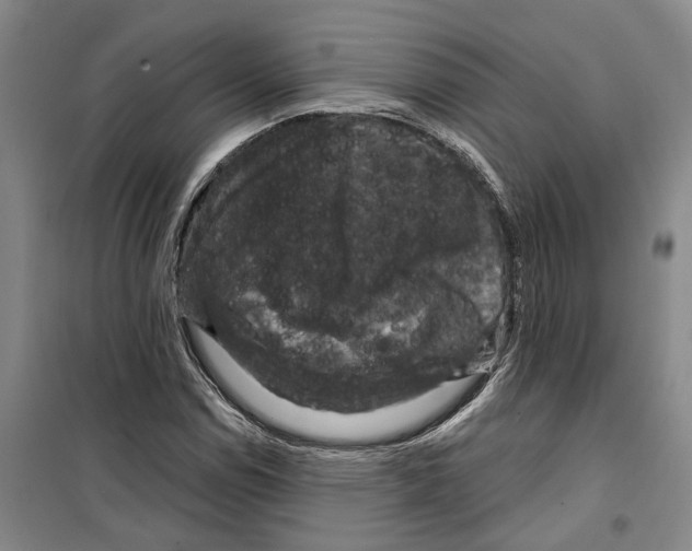 X0000099381114200806051114