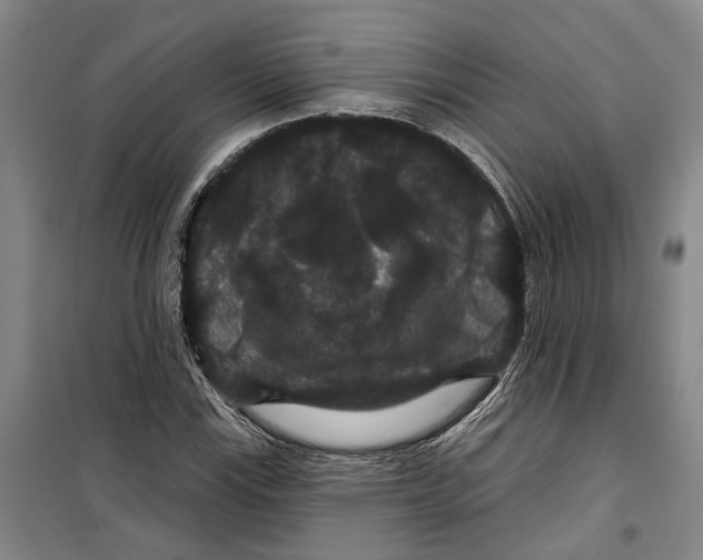 X0000099381115200806051114