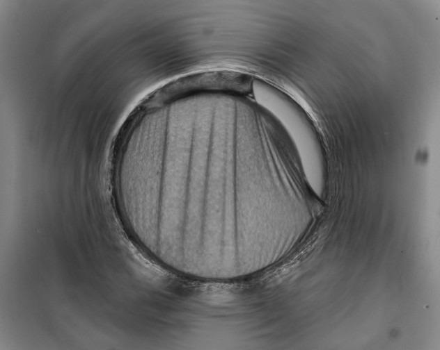 X0000099381116200806051114