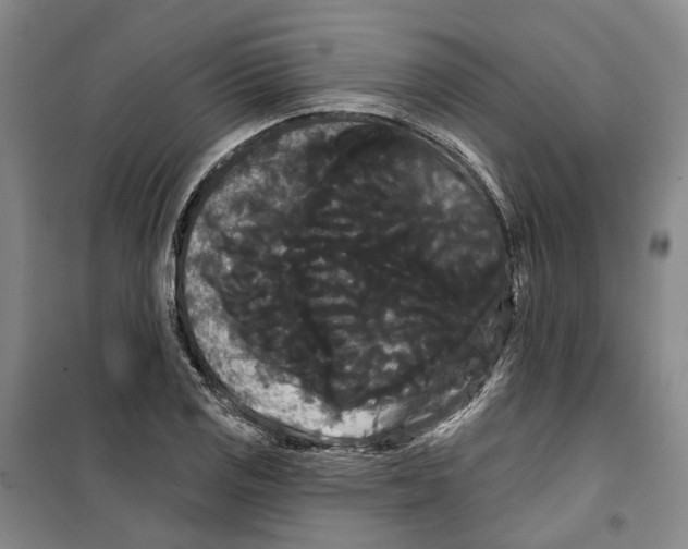 X0000099381125200806051114