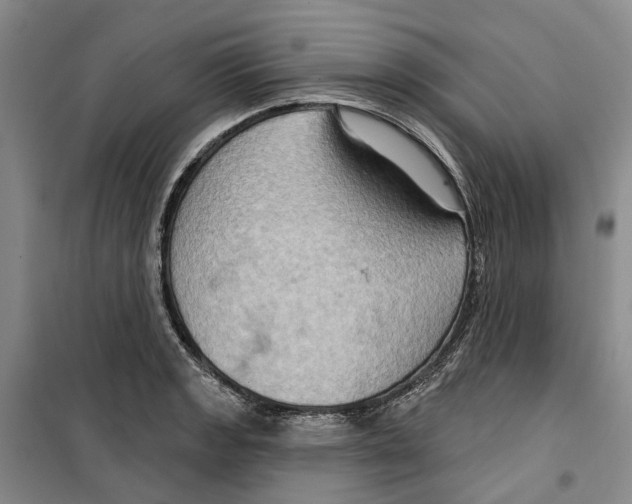 X0000099381133200806051115