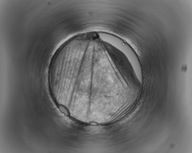 X0000099381134200806051115