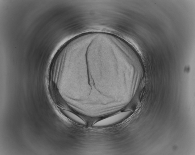 X0000099381136200806051115