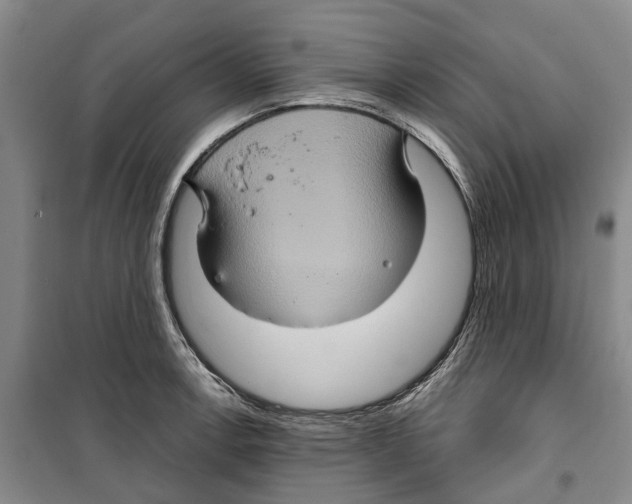 X0000099381138200806051115