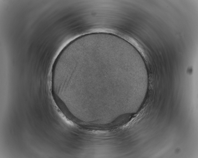 X0000099381140200806051115