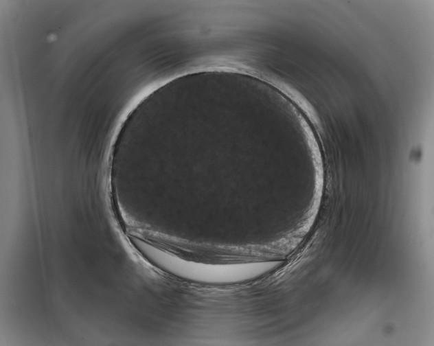 X0000099381144200806051115