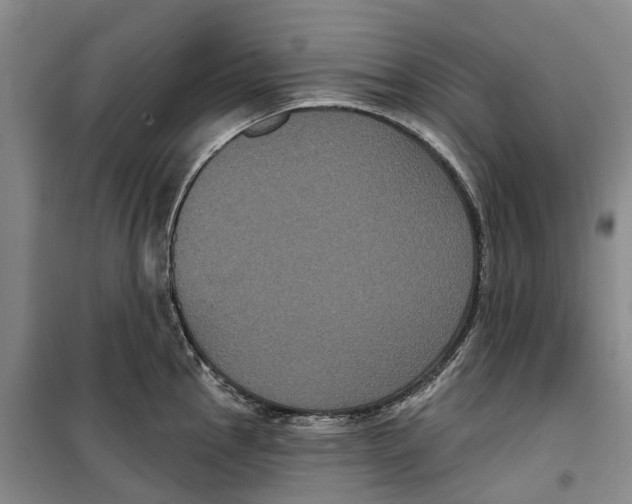 X0000099381145200806051115