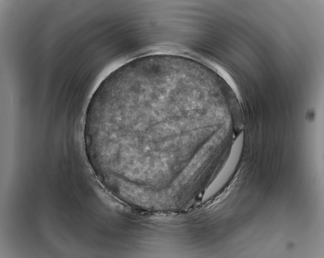 X0000099381146200806051115