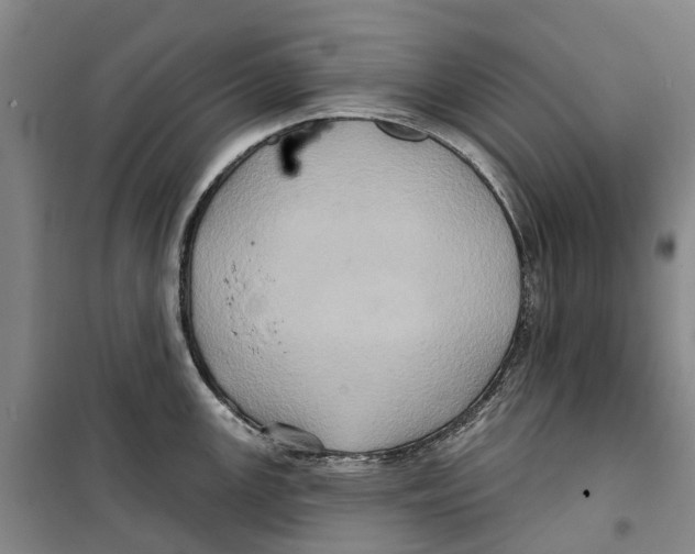 X0000099381147200806051115