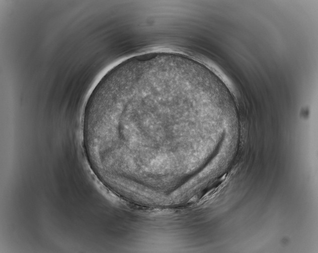 X0000099381148200806051115